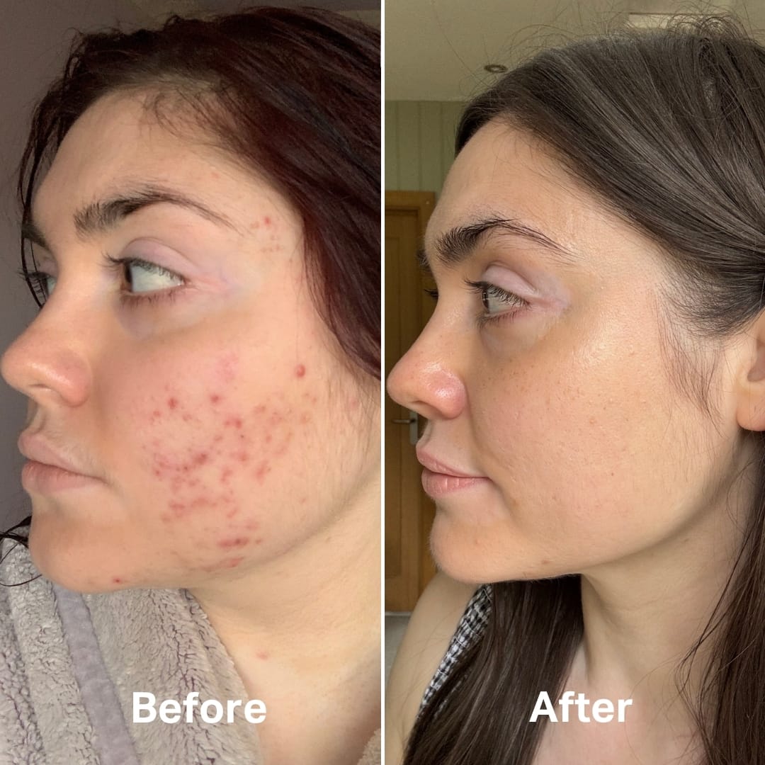 Customer photo review of Bakuchiol Booster