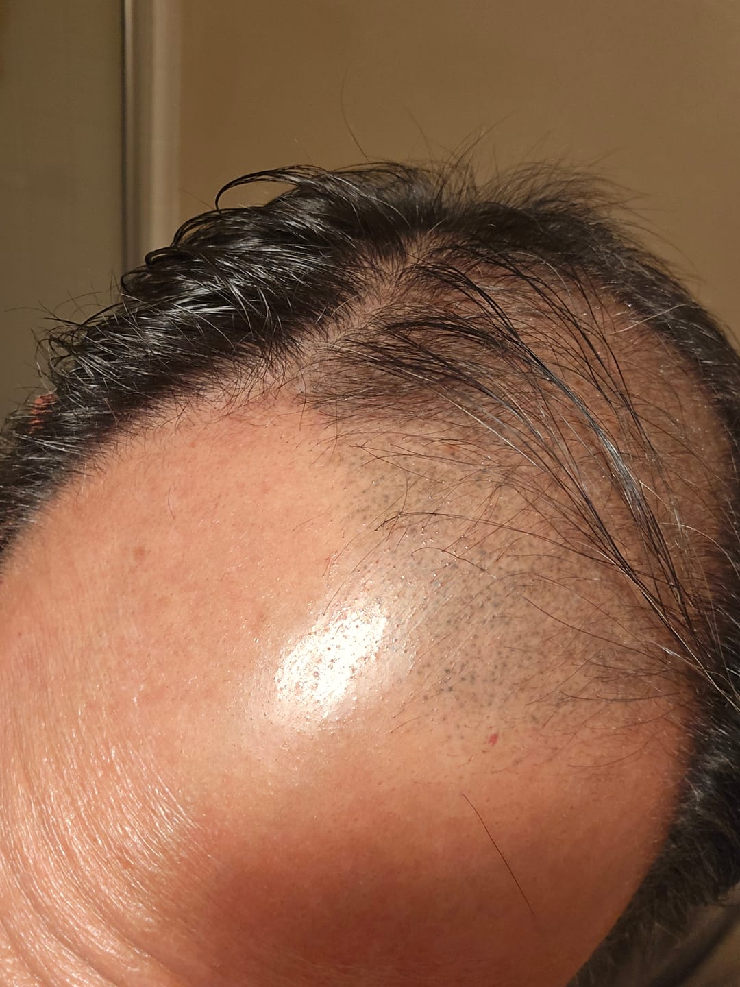 Customer photo review of SPARTAN™ - Root Activator Shampoo