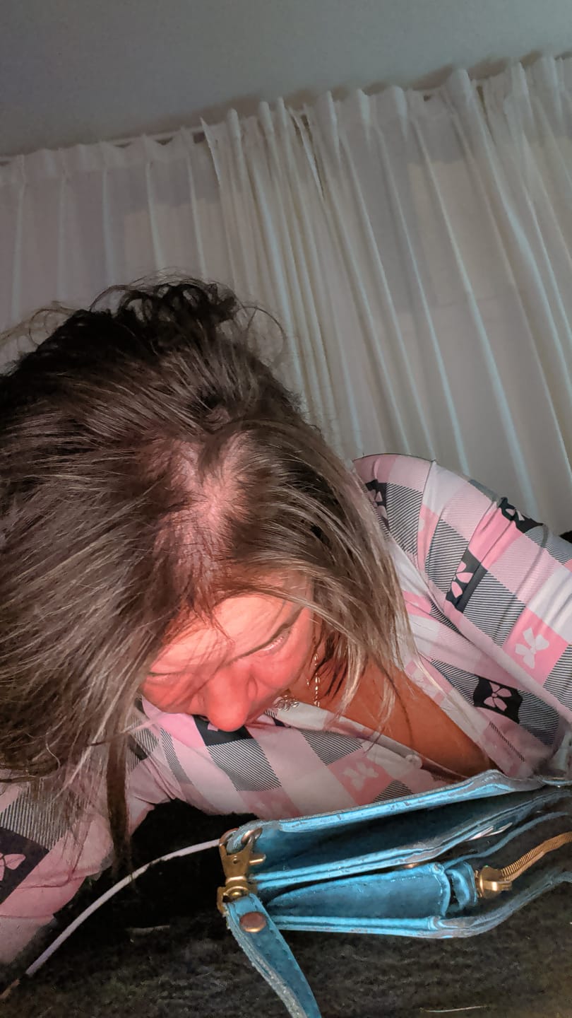 Customer photo review of Pre-Wash Scalp fortifying oil - Rosemary