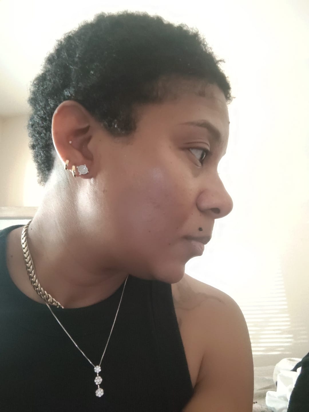 Customer photo review of Scalp Stimulating Elixir