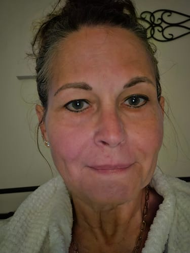Reviewer shows her smooth, glowing skin after using The Micro Infusion System™.