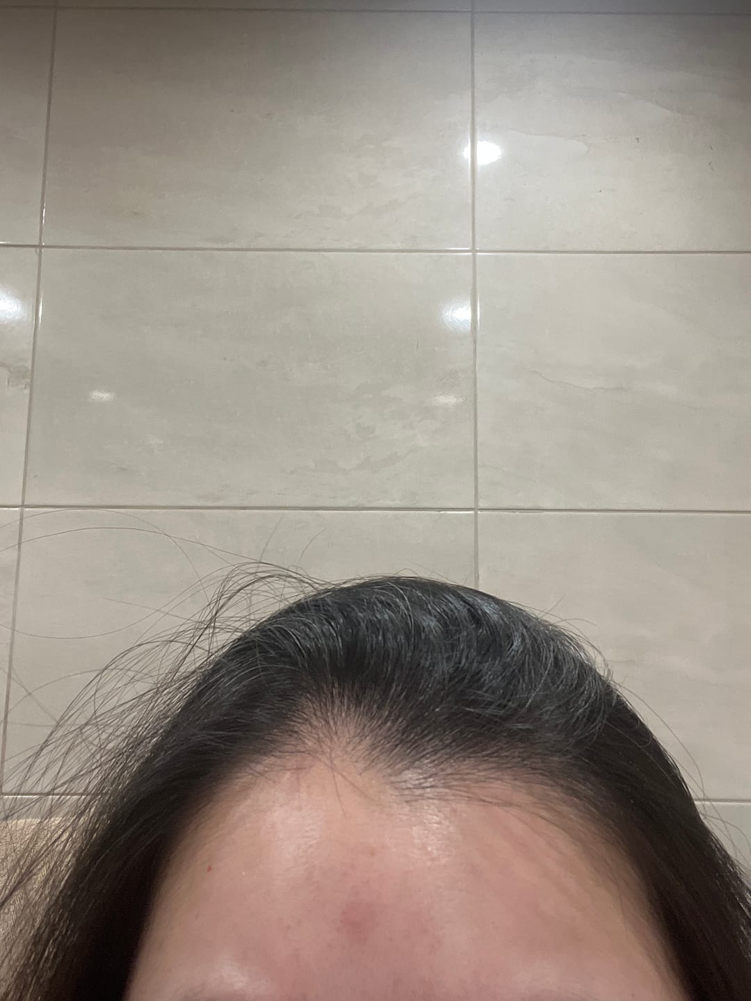 Customer photo review of Scalp Balance Set