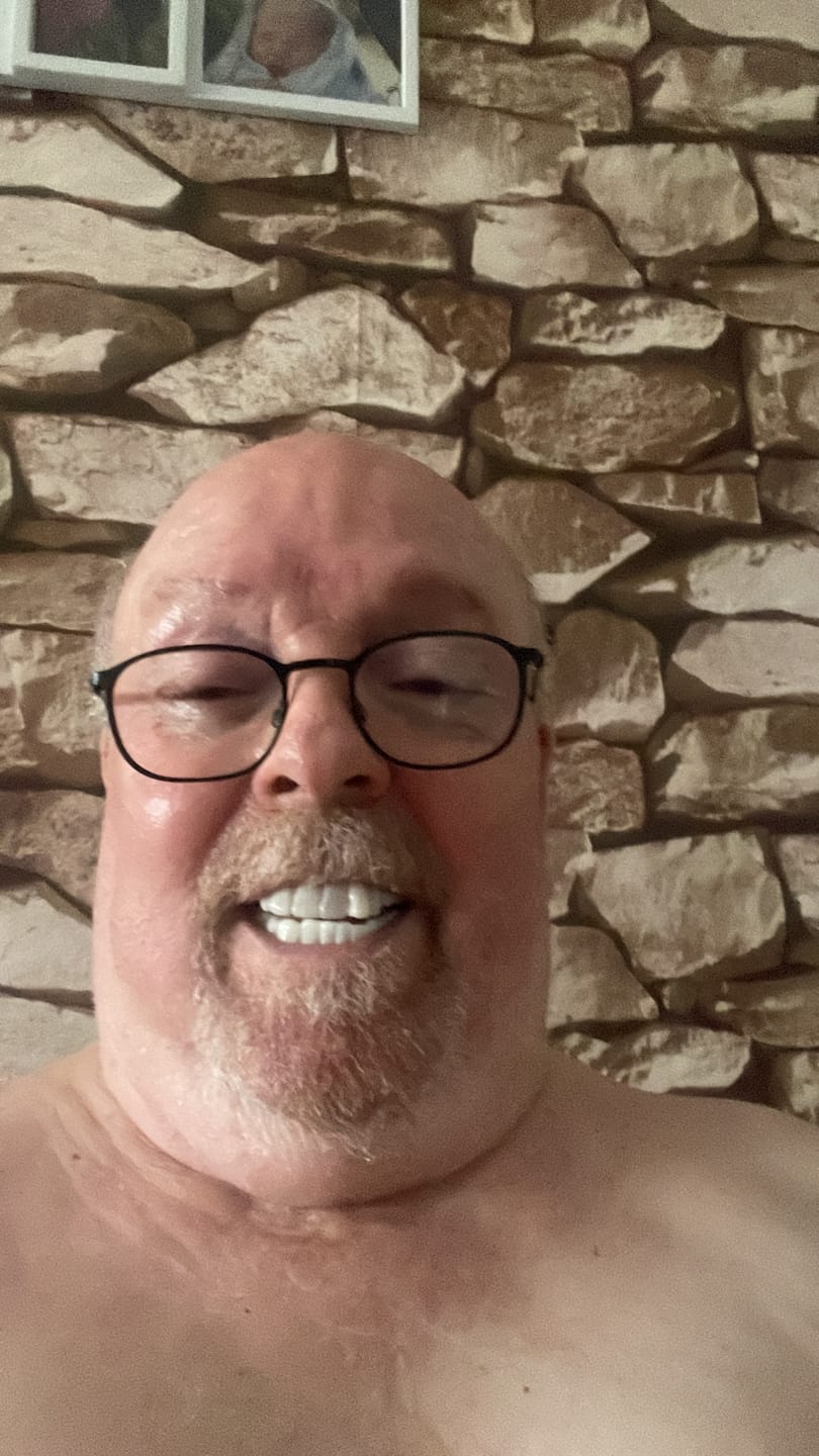 Customer photo review of Click-in Veneers 4.0