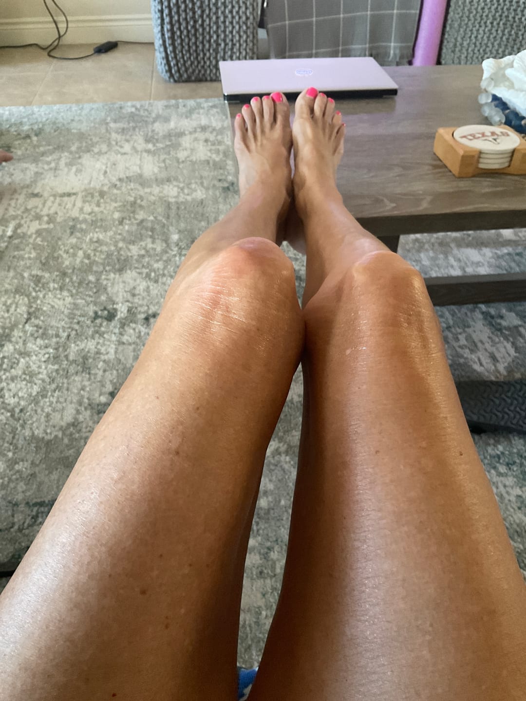 Customer photo review of Besque® Magic Body Oil - Unscented