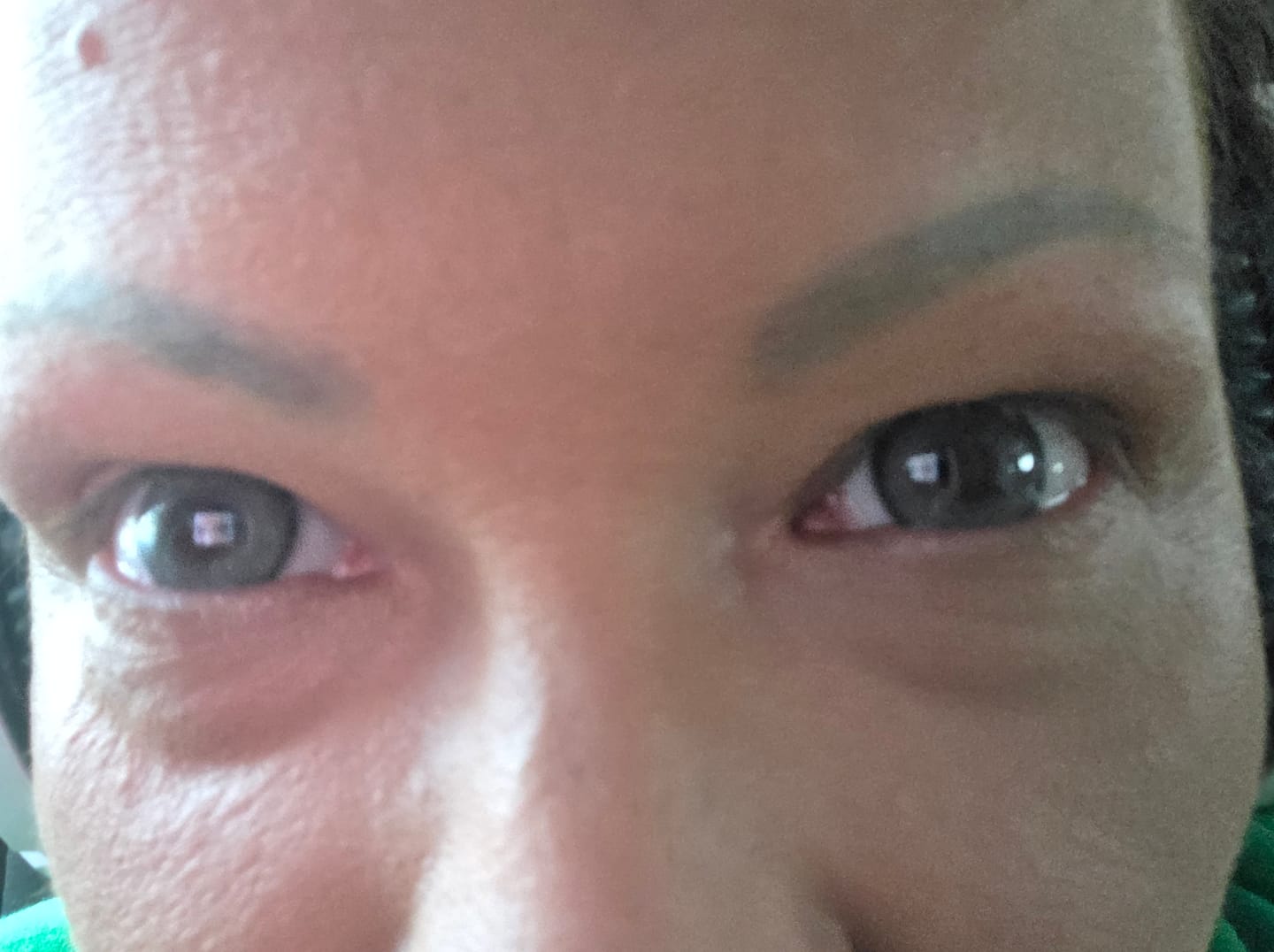 Customer photo review of New York Blue Prescription Colored Contact Lenses