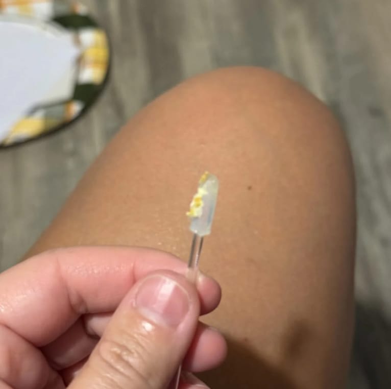 Customer photo review of ClearTip (24 darab)
