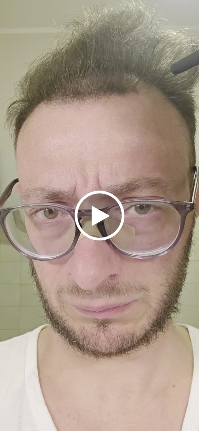 Customer video review of Fibre copri Calvizie da 27.5gr  | Castano Scuro | 60 Giorni di applicazioni