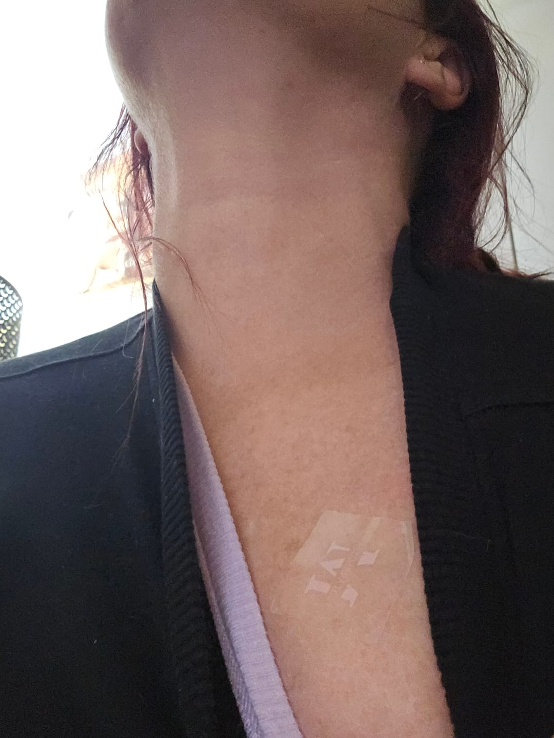 Customer photo review of alumepatch menopause patch