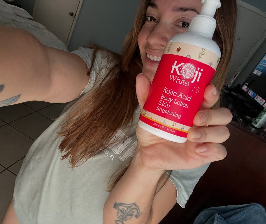 Customer photo review of Kojic Acid Skin Brightening Body Lotion
