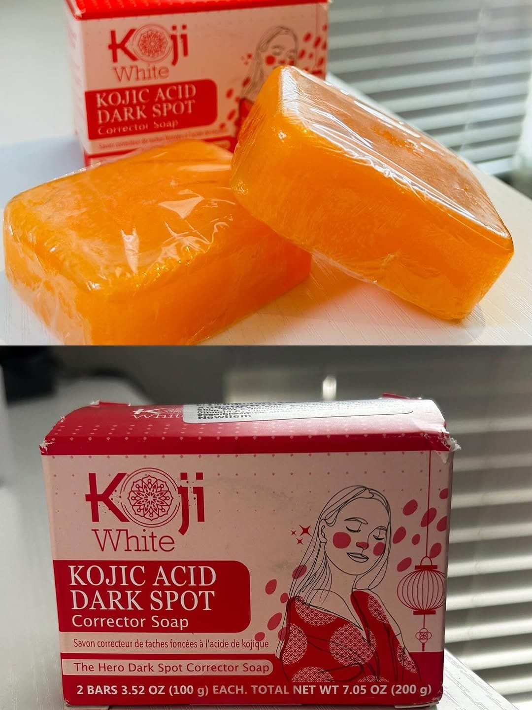Customer photo review of Dark Spot Corrector Soap 2-Bars