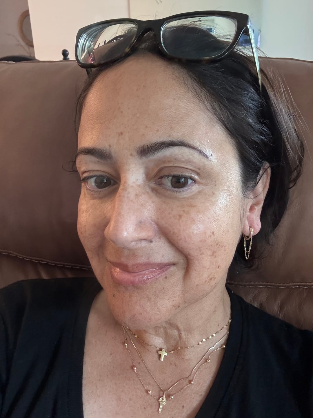 Customer photo review of The Complete System for Mature Women’s Skin