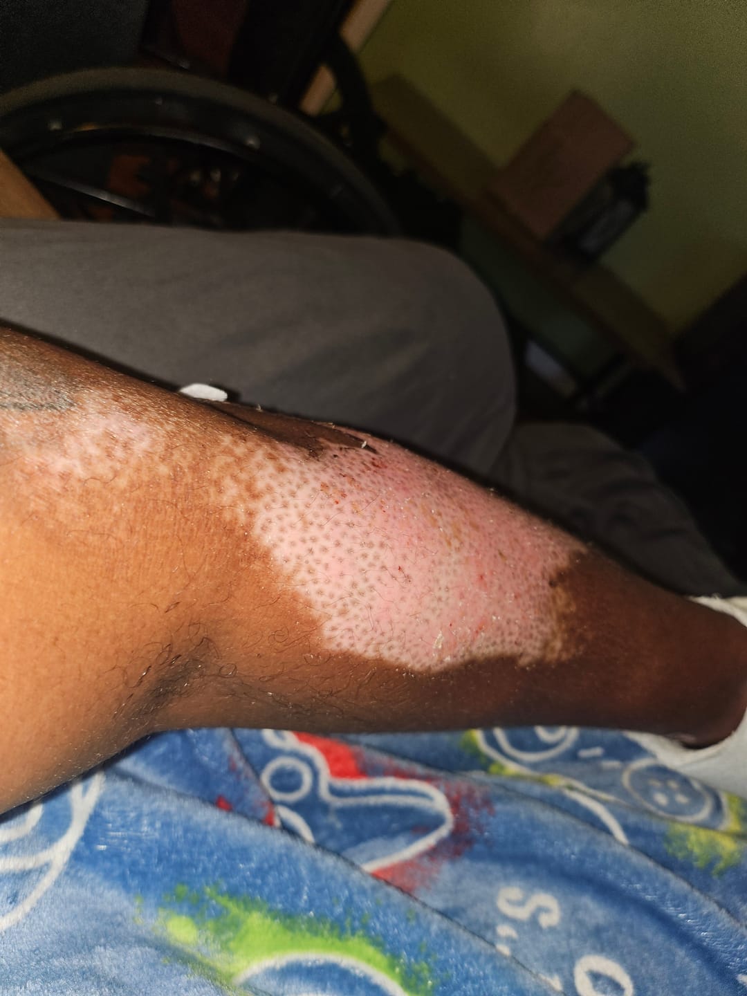 Customer photo review of Extra Strength Sweet Ginger Vapor Rub [Compact]