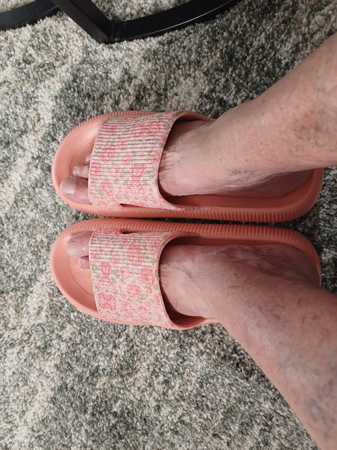 Customer photo review of HappyFlops Botanics