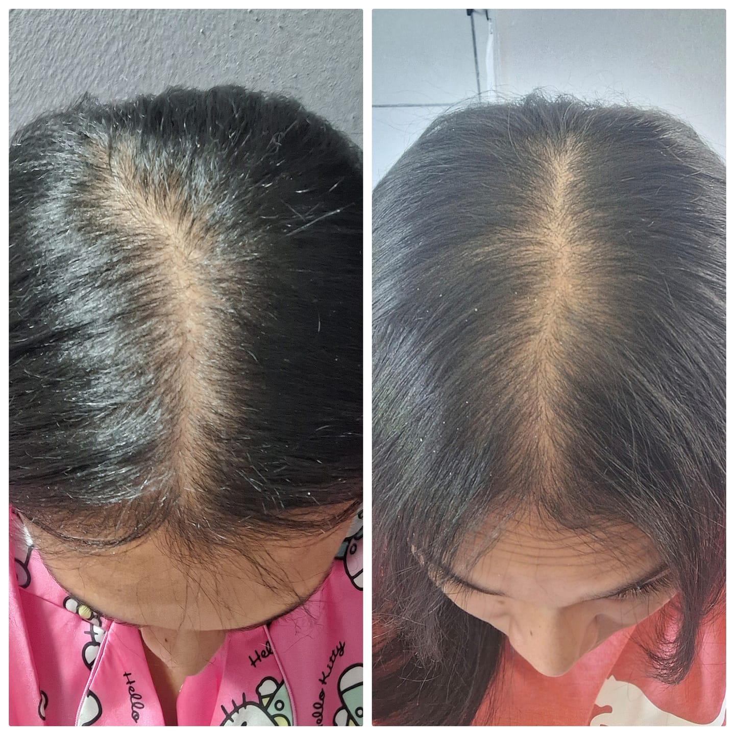 Customer photo review of DEEPLY ROOTED DUO - Advanced Nutraceutical Hair Growth Formula