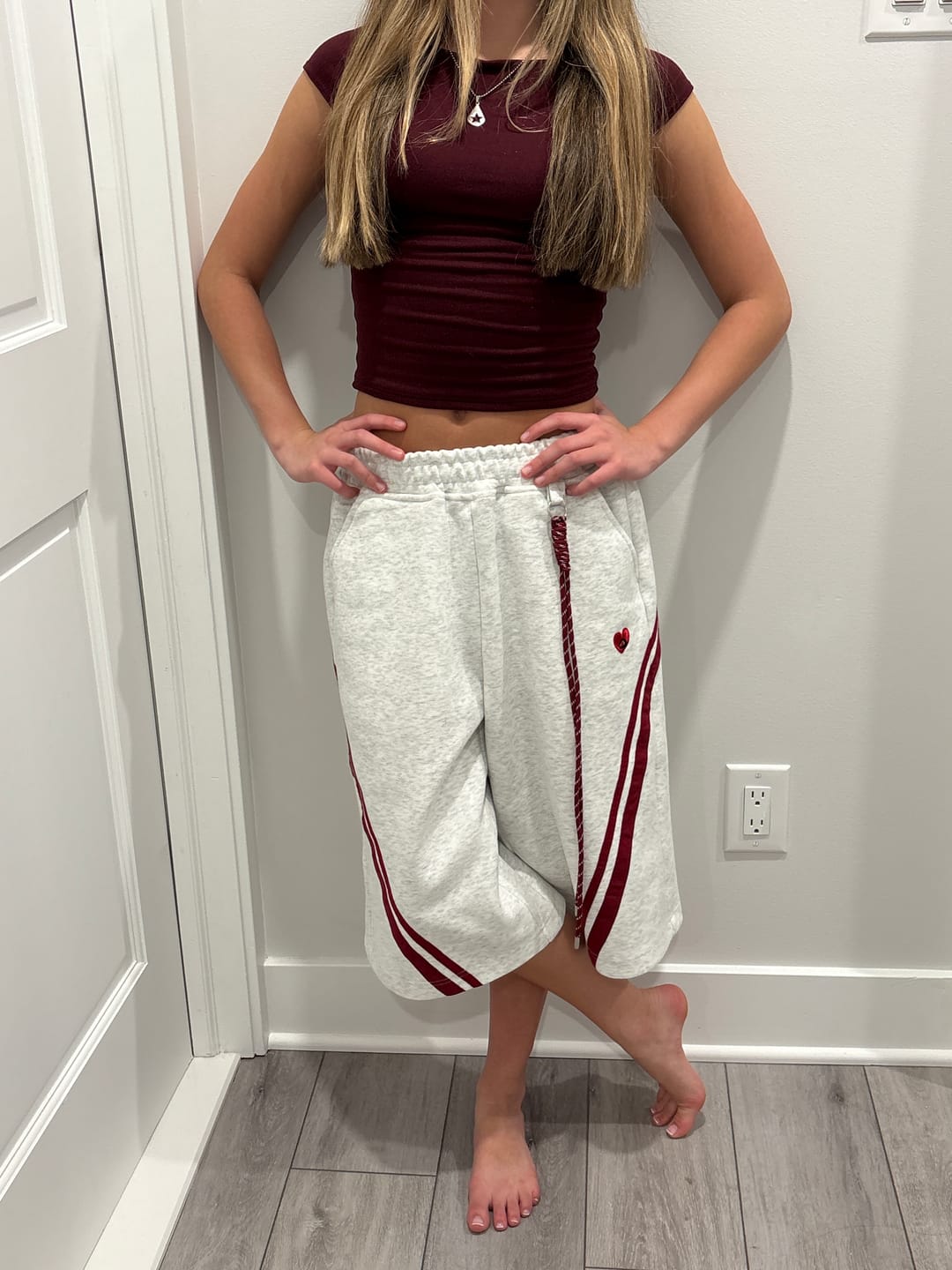 Customer photo review of Aelfric Eden Stripe Longline Shorts