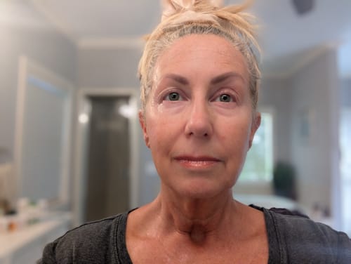 A reviewer's selfie showing clear, glowing skin after using the Seranova Micro Infusion System.