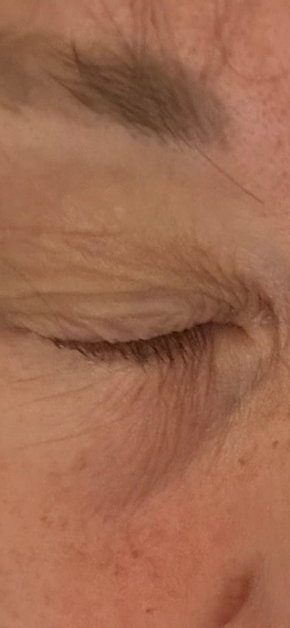 Customer photo review of Eyelash Serum