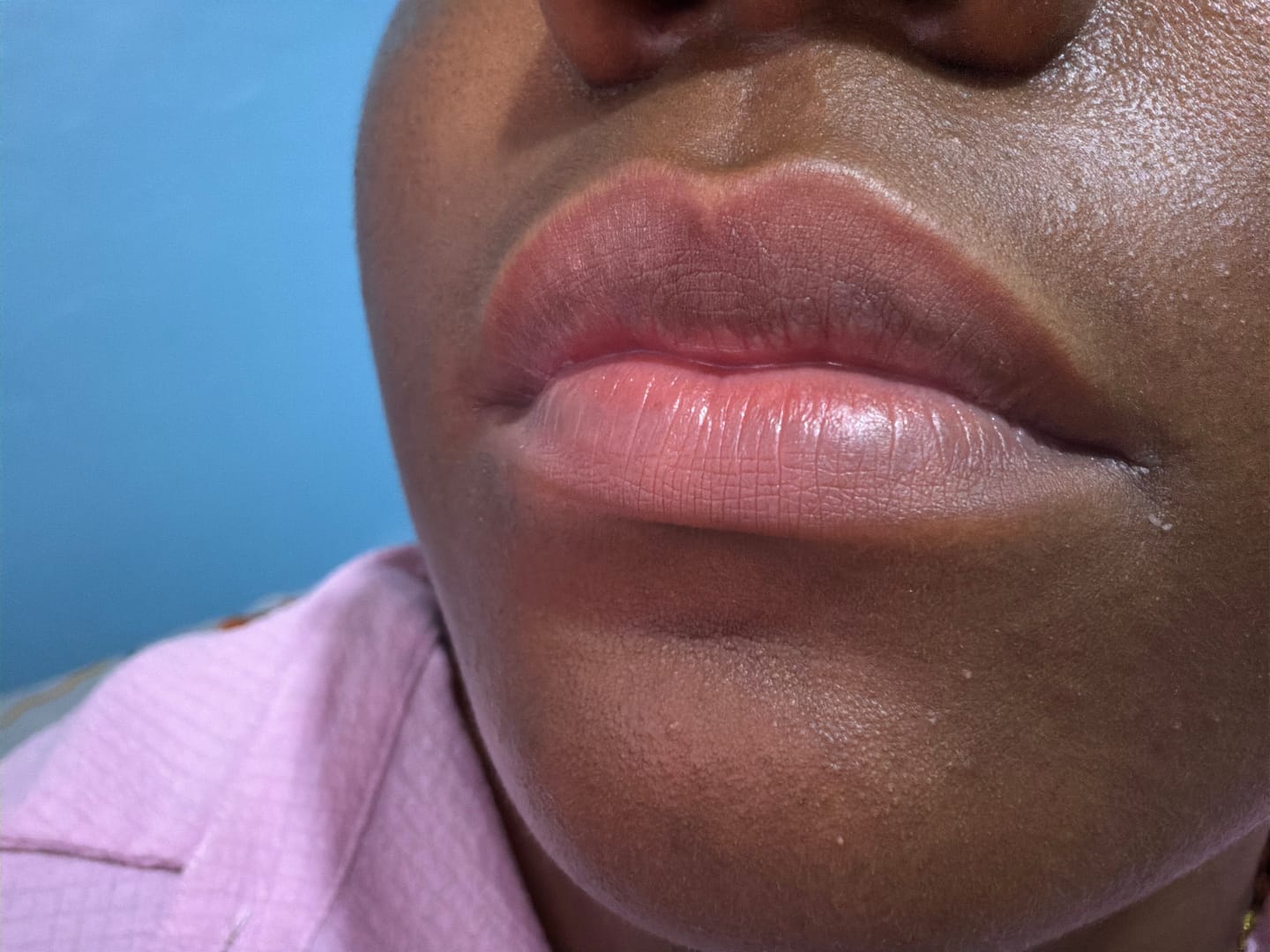 Customer photo review of BAUME À LÈVRE ROSE PERMANENT, EXFOLIE, ROSIE ET HYDRATE