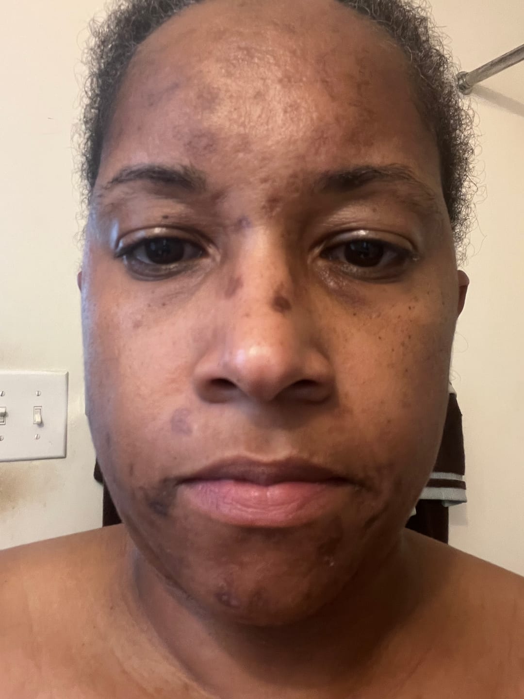 Customer photo review of Melanin Skin Bundle