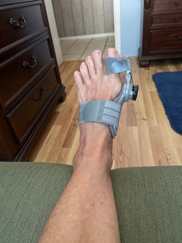 Customer wearing the Treatmedy™ Bunion Fix on their foot to help align the big toe.