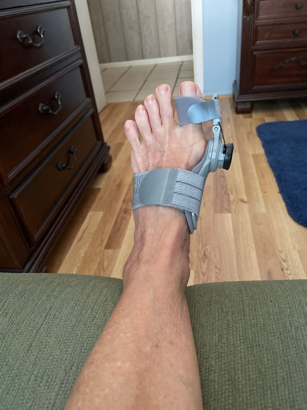 Customer photo review of Treatmedy™ Bunion Fix