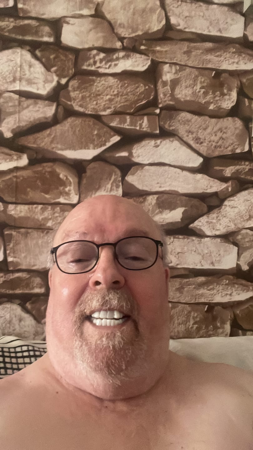 Customer photo review of Click-in Veneers 4.0