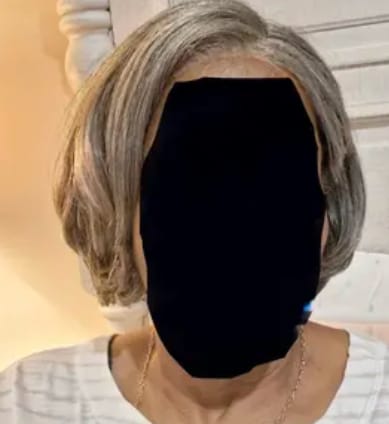 Customer photo review of Luvwin Salt And Pepper 5x5 Closure Pixie Cut Side Part Glueless Wig