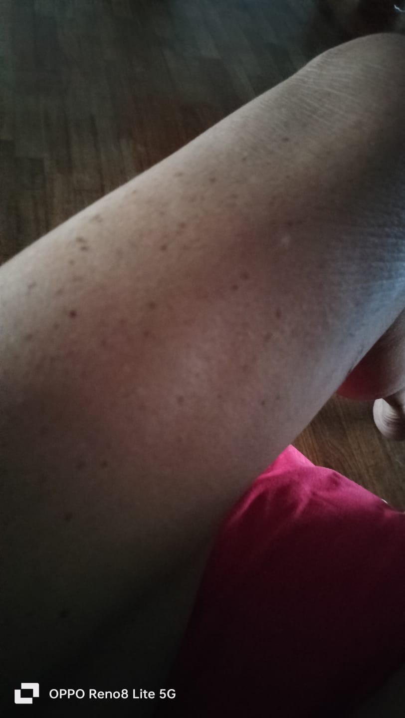 Customer photo review of Crema idratante corpo
