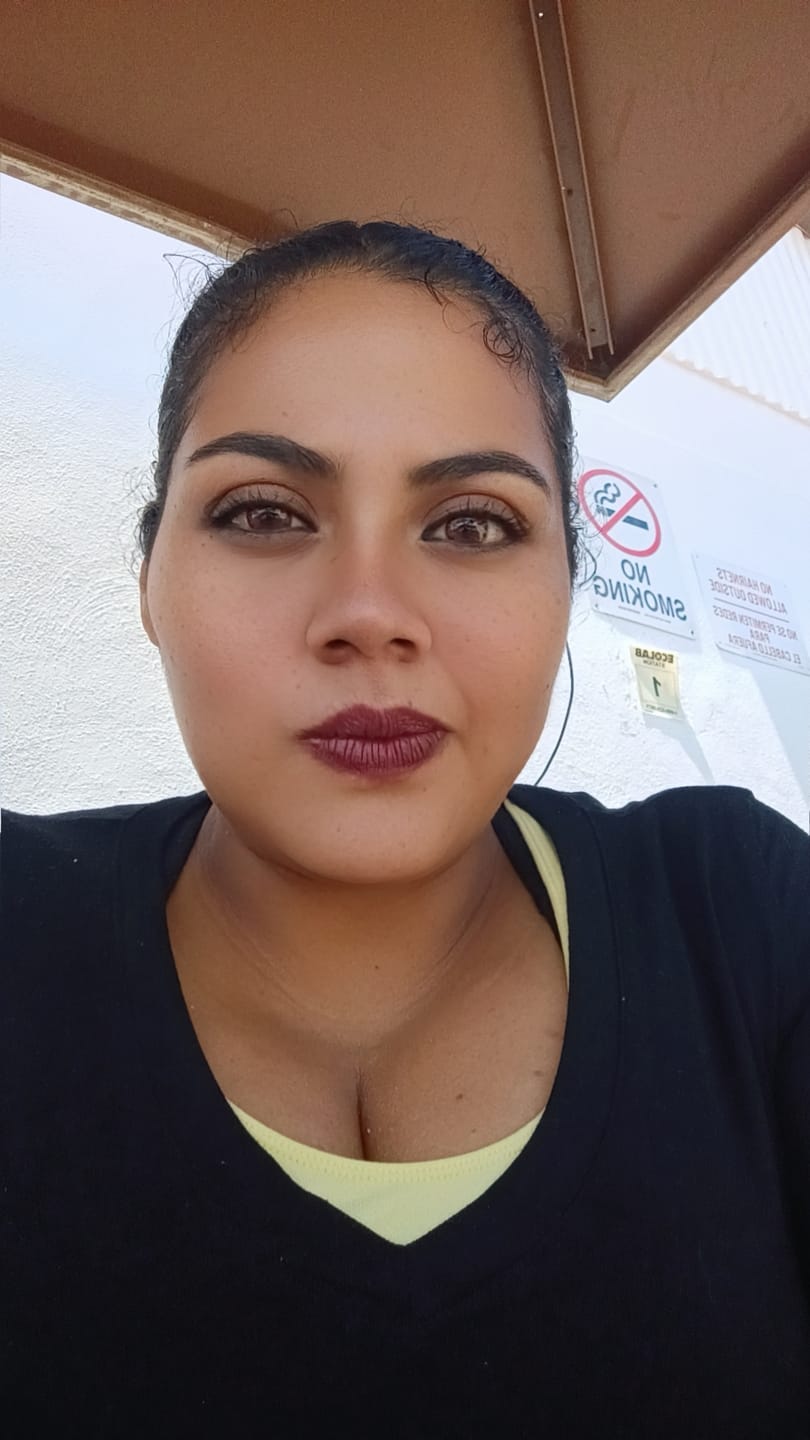 Customer photo review of Three Tone HONEY Brown Prescription Coloured Contact Lenses