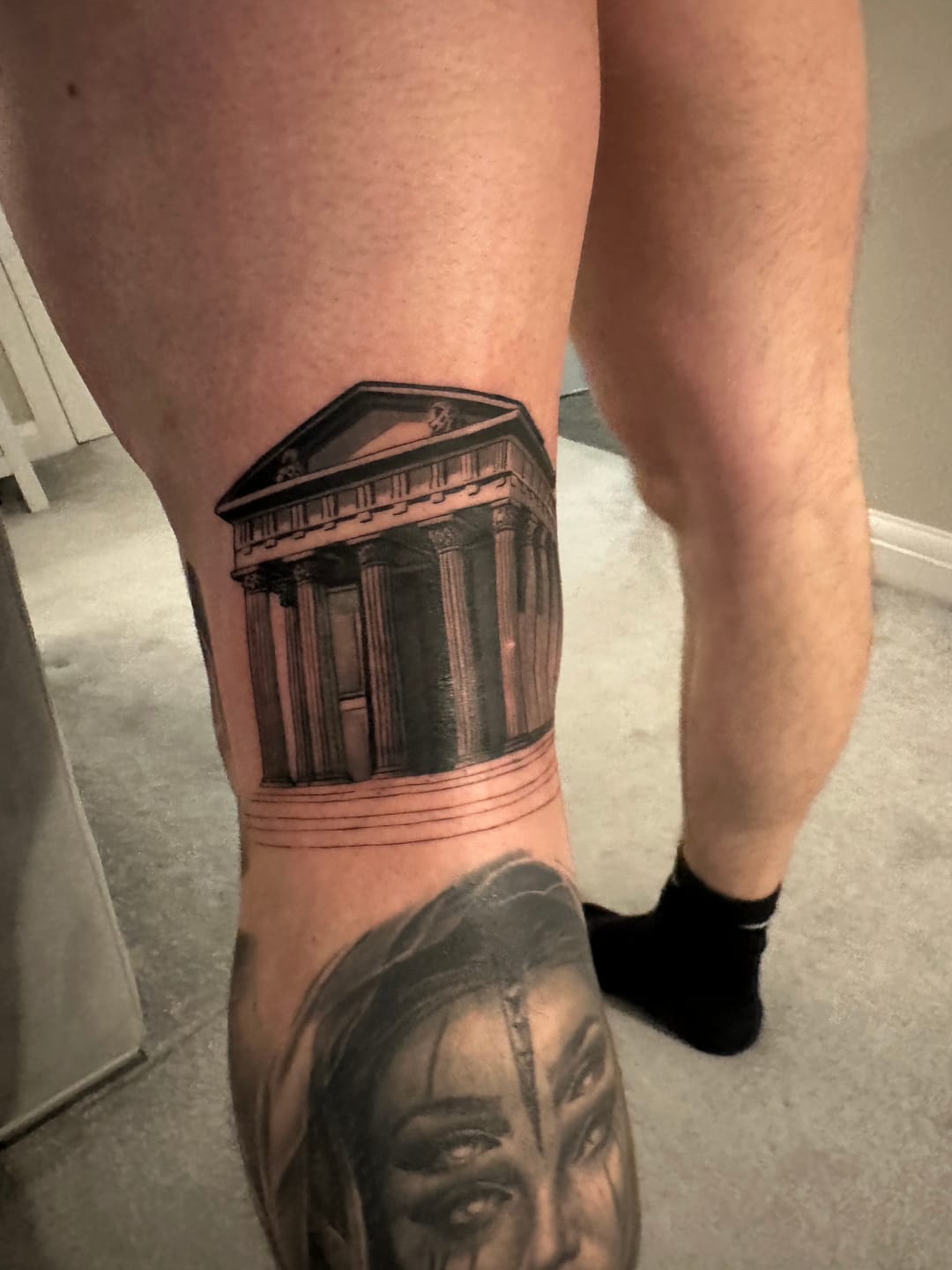 Customer photo review of TattooNumbx Numbing Cream