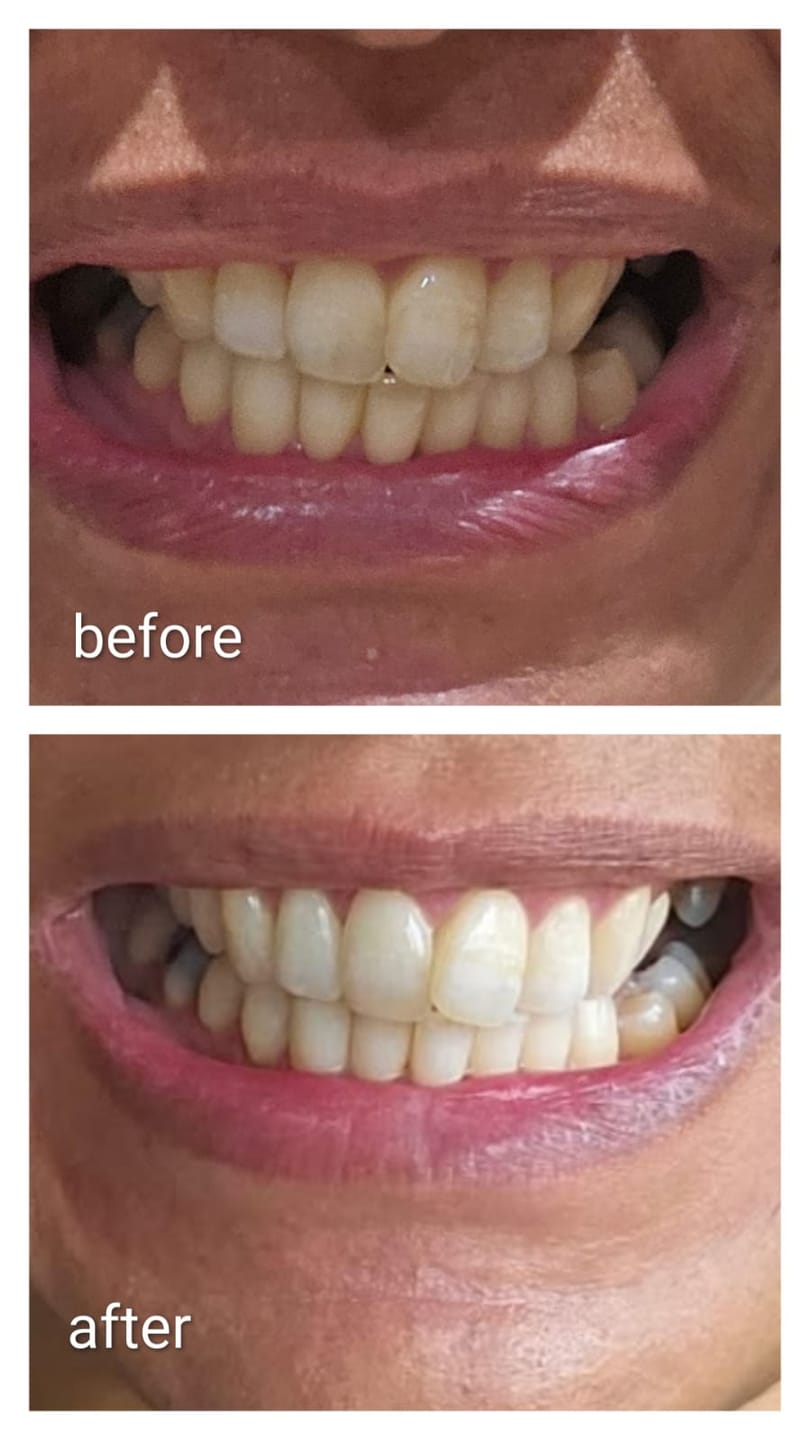 Customer photo review of Teeth Whitening Toothpaste