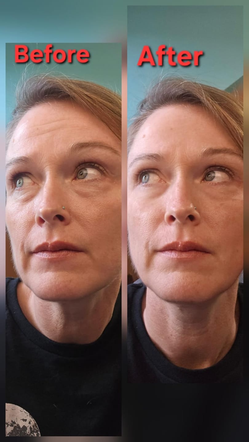 Customer photo review of Instant Firming Temporary Face Tightener Easy-Wear Formula