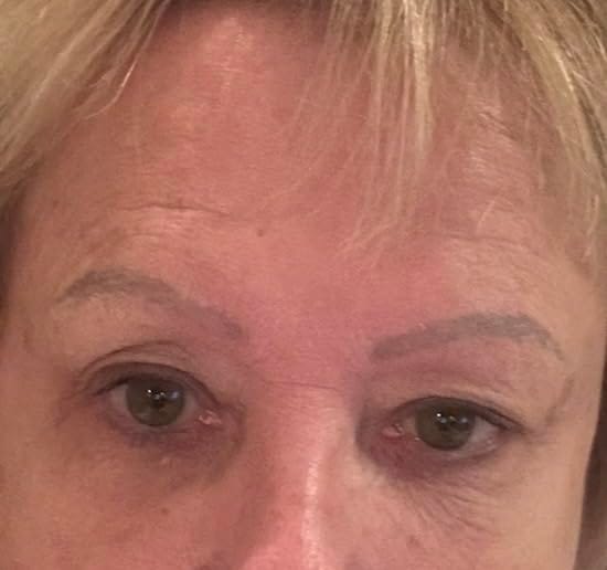 Customer photo review of Instant Firming Temporary Face Tightener Easy-Wear Formula