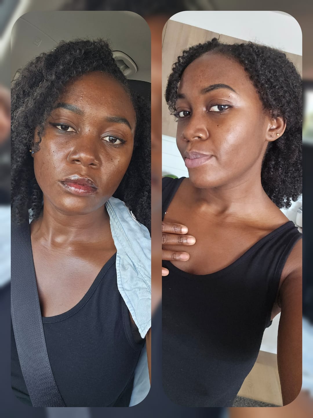 Customer photo review of The Gold Glo Supplement System/Duo Gélules