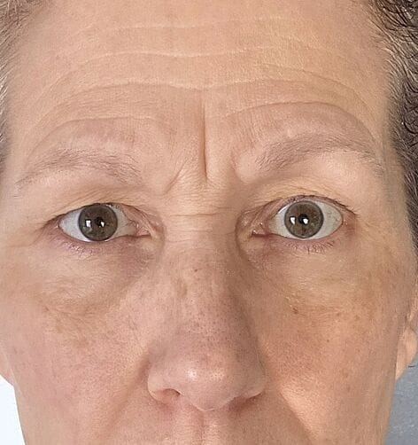 Customer photo review of Instant Firming Temporary Face Tightener Easy-Wear Formula