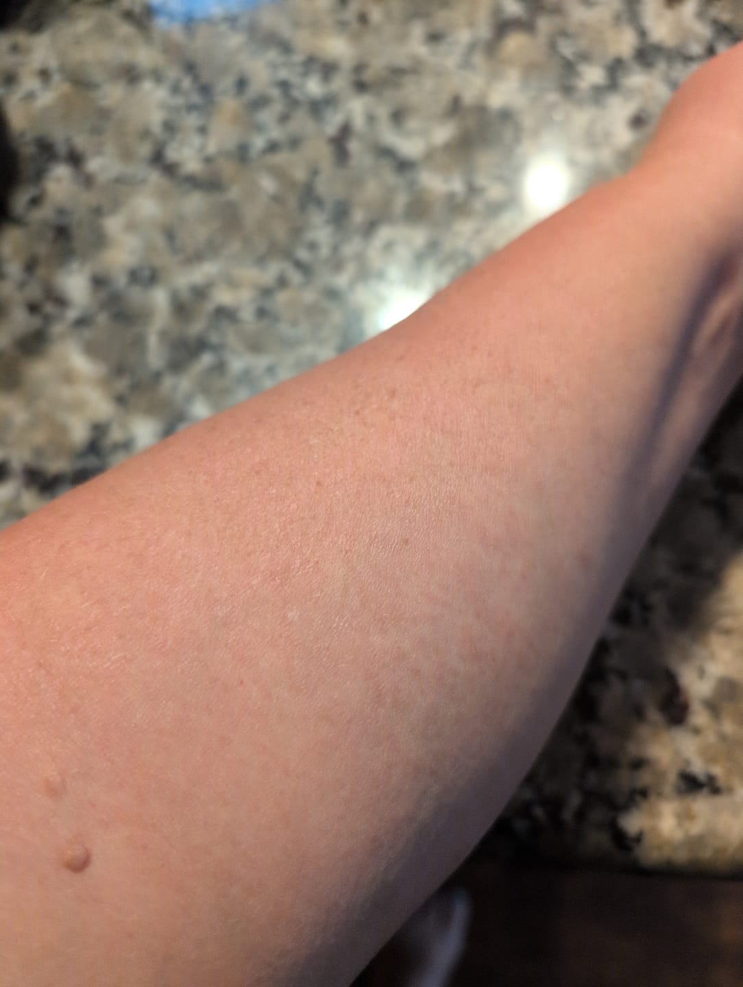 Customer photo review of AGR+E Overnight PMLE Relief Lotion