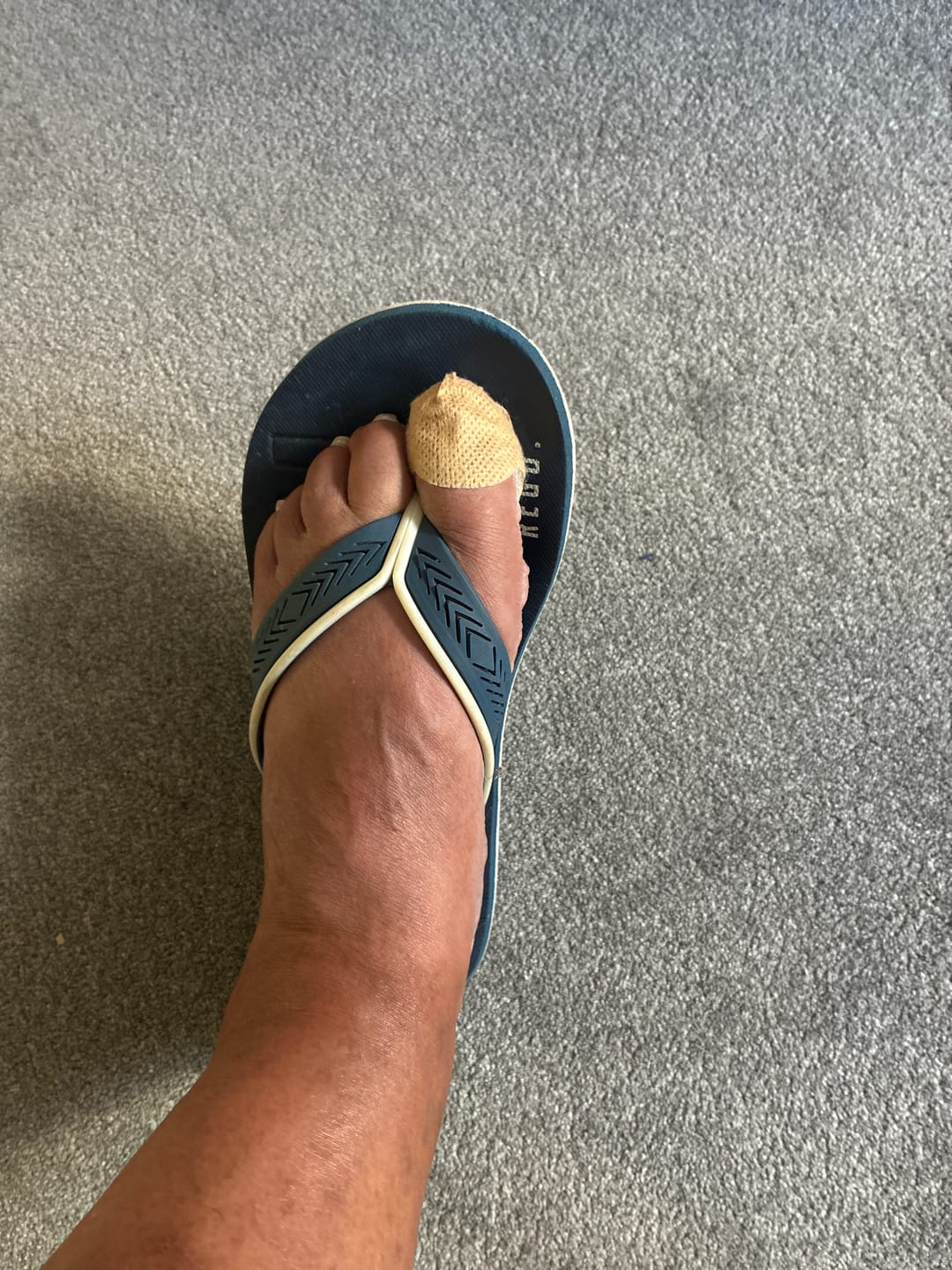 Customer photo review of VELCURA™ Fungal Nail Patches