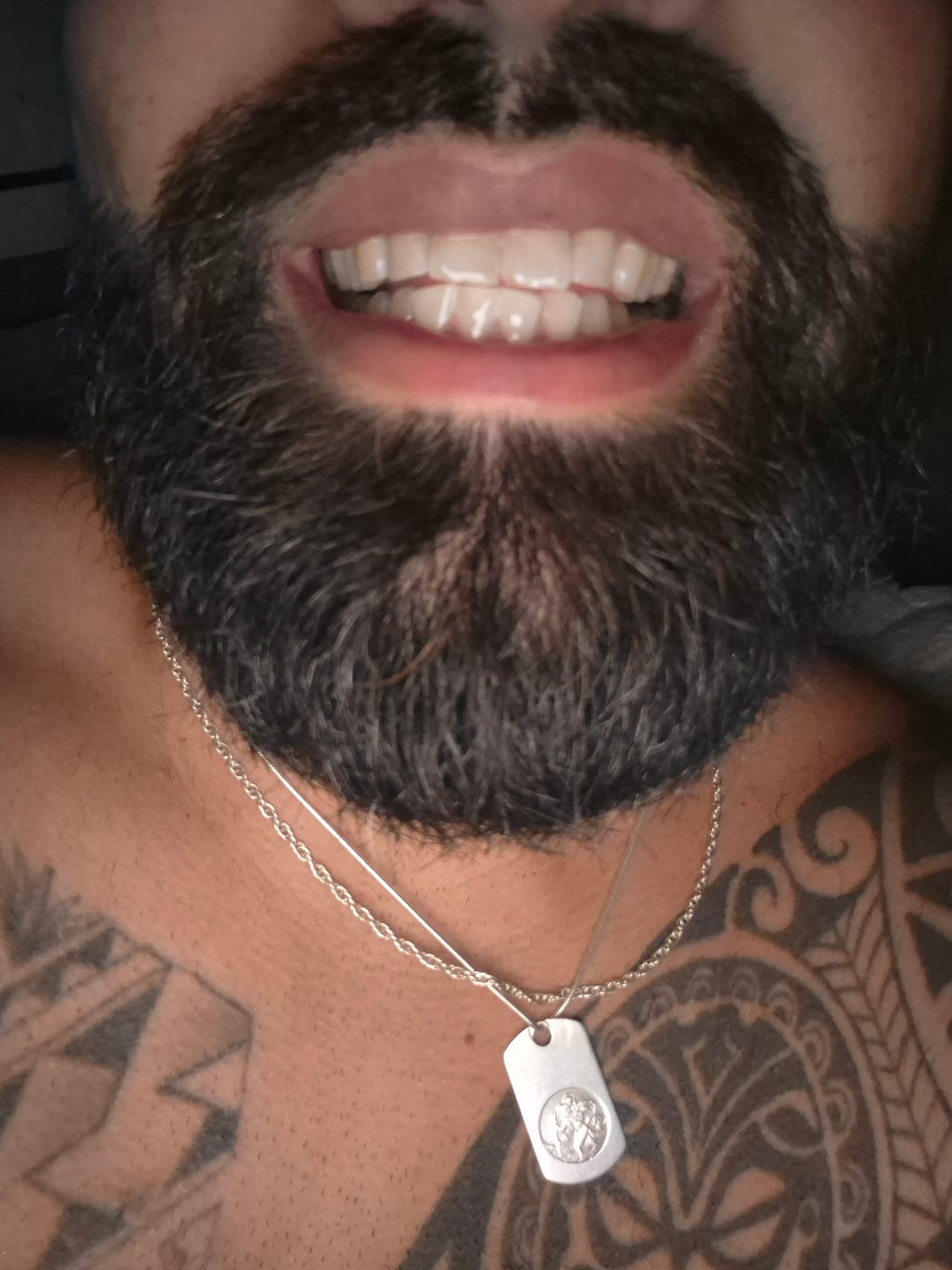 Customer photo review of Teeth Whitening Powder