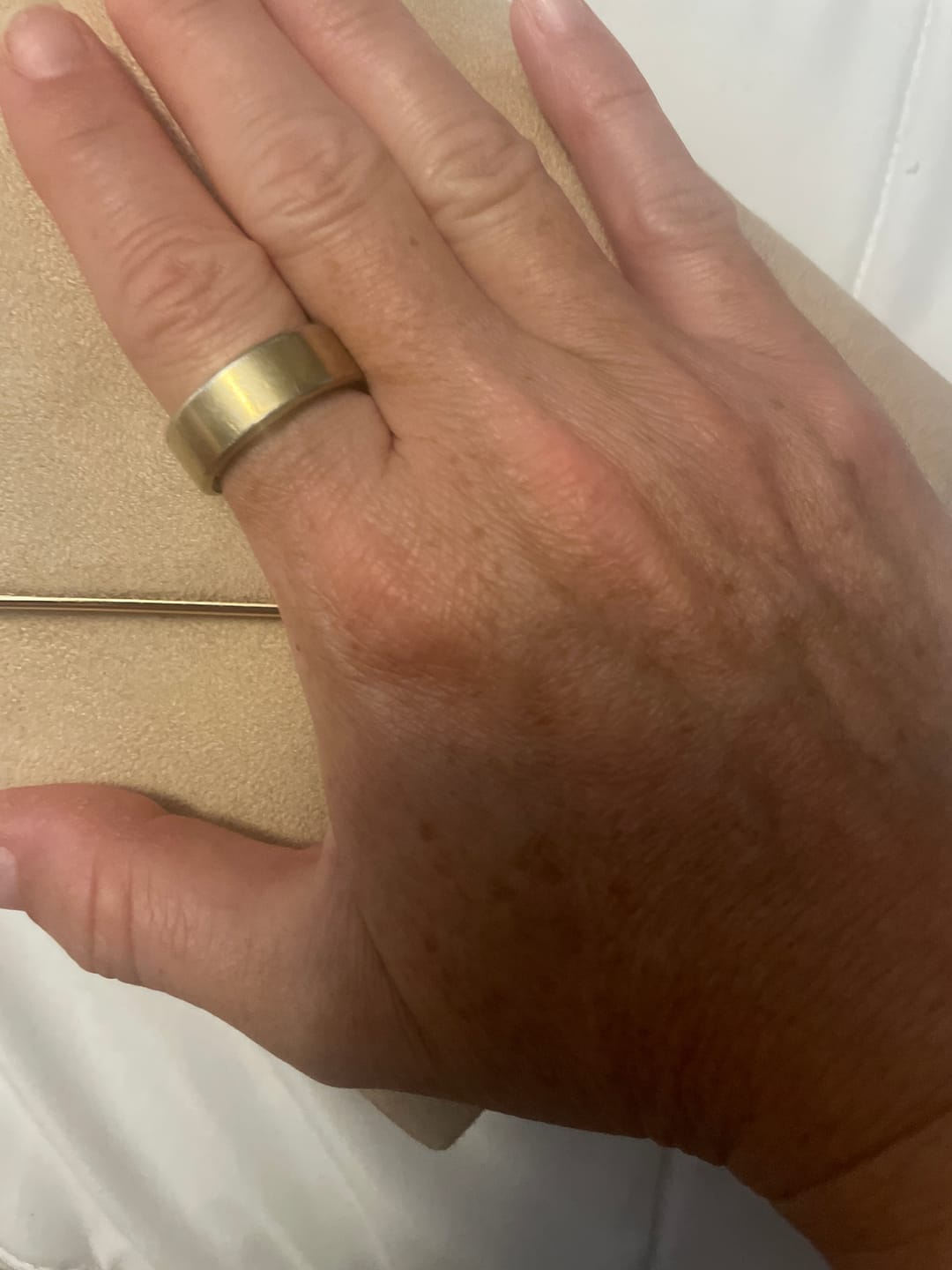 Customer photo review of Optim Ring