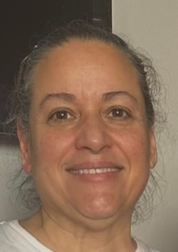 Reviewer showing their face after 10 treatments with the Seranova Micro Infusion System.