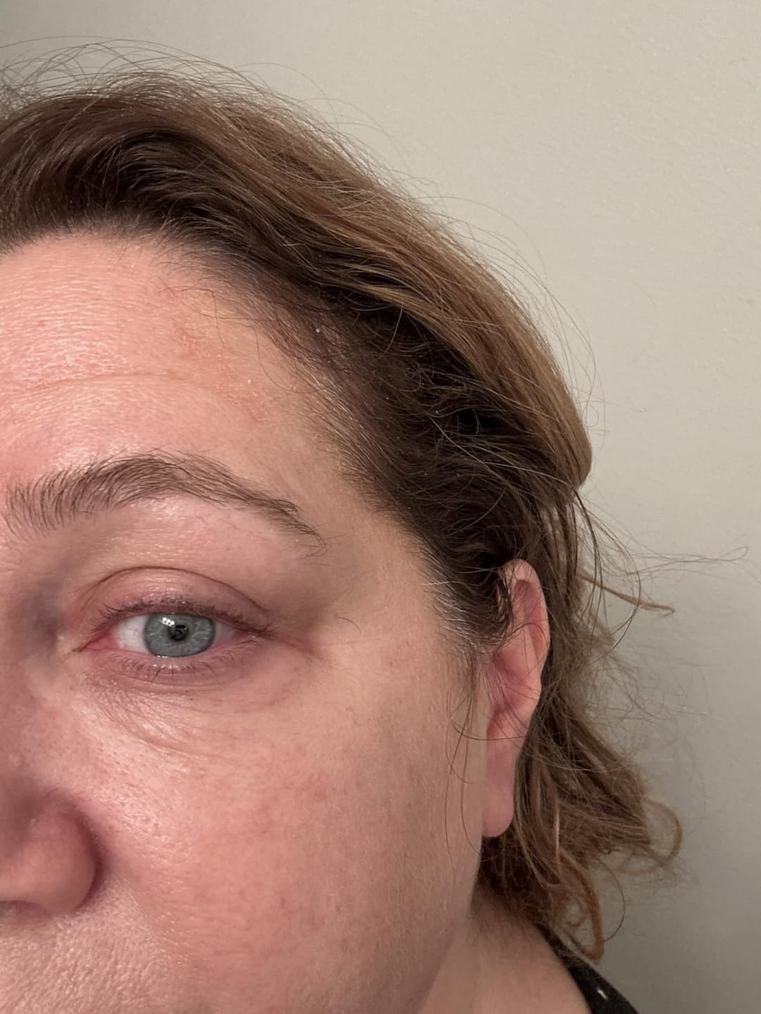 Customer photo review of Instant Firming Temporary Face Tightener Easy-Wear Formula
