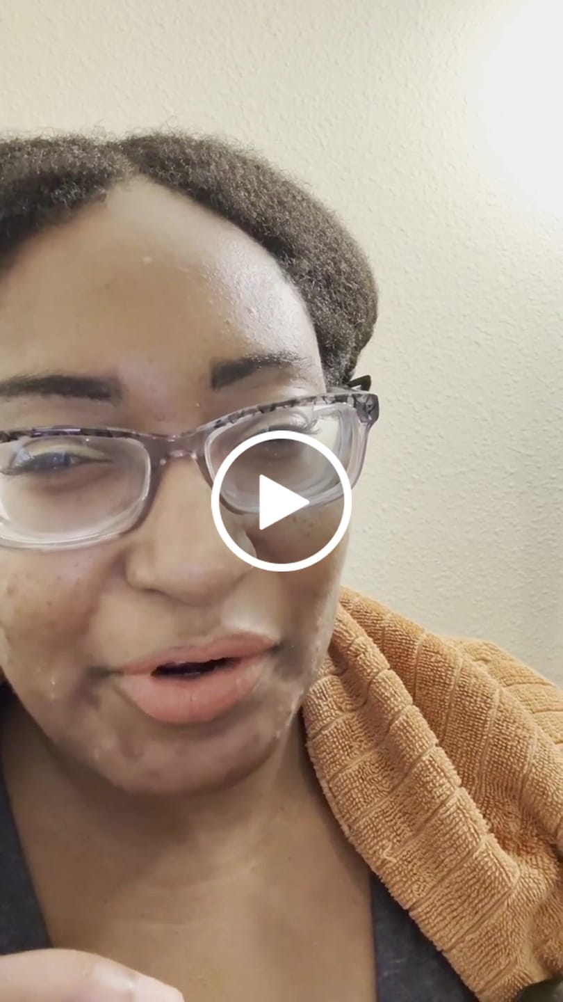 Customer video review of Super Hair Growth Serum
