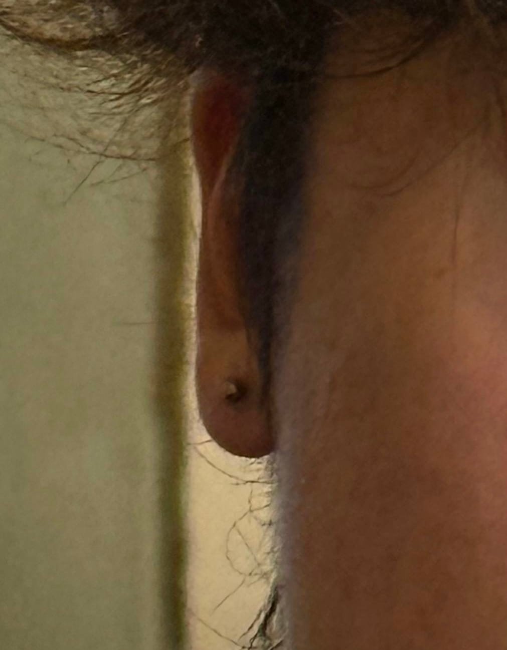 Customer photo review of Gentle Piercing