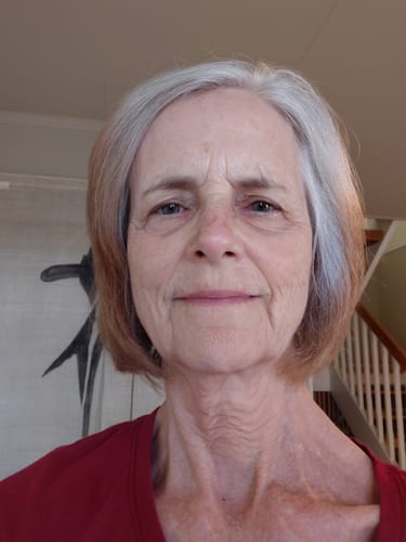 Customer's face without makeup, showing the results of using the Seranova Micro Infusion System.