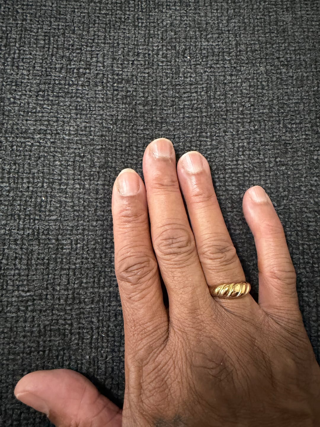 Customer photo review of Twisted Ring