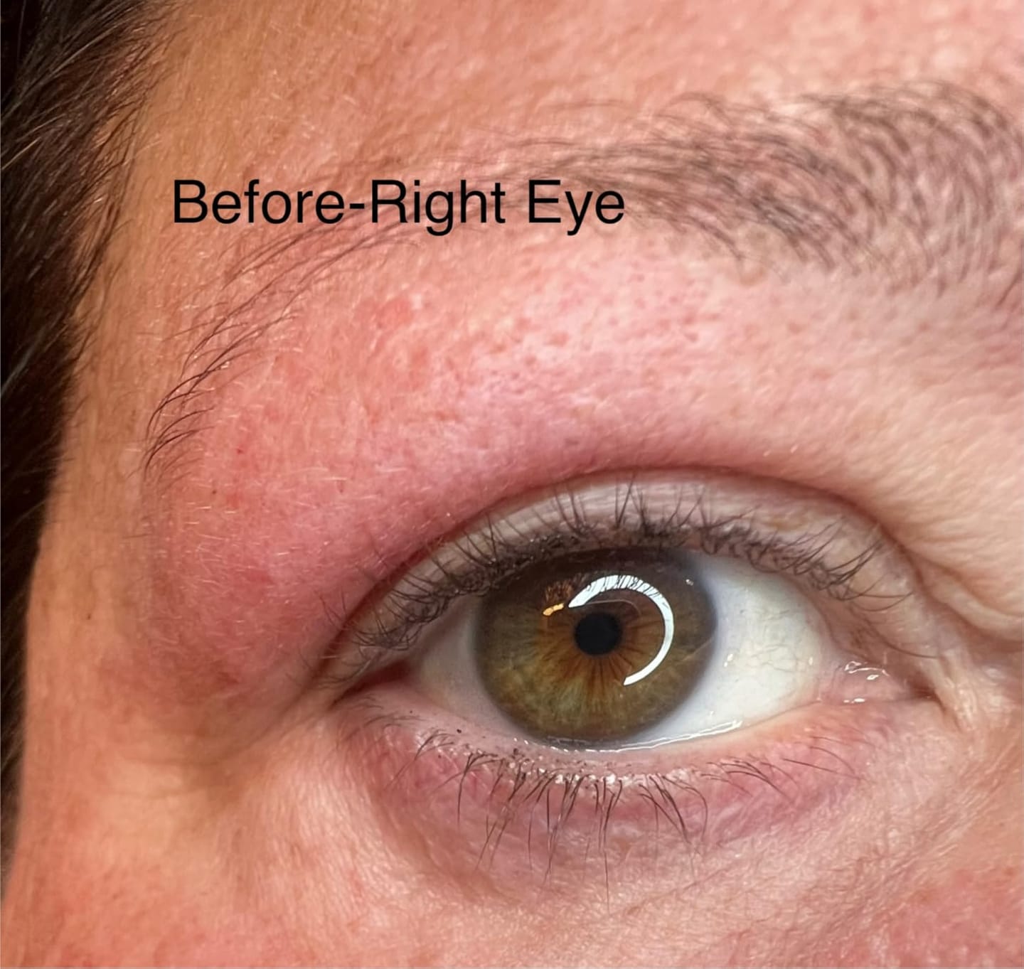Customer photo review of Instant Firming Temporary Face Tightener Easy-Wear Formula