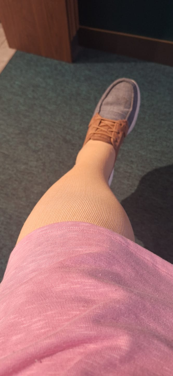 Customer photo review of EverSock™ Wide Compression Socks For Pain Relief