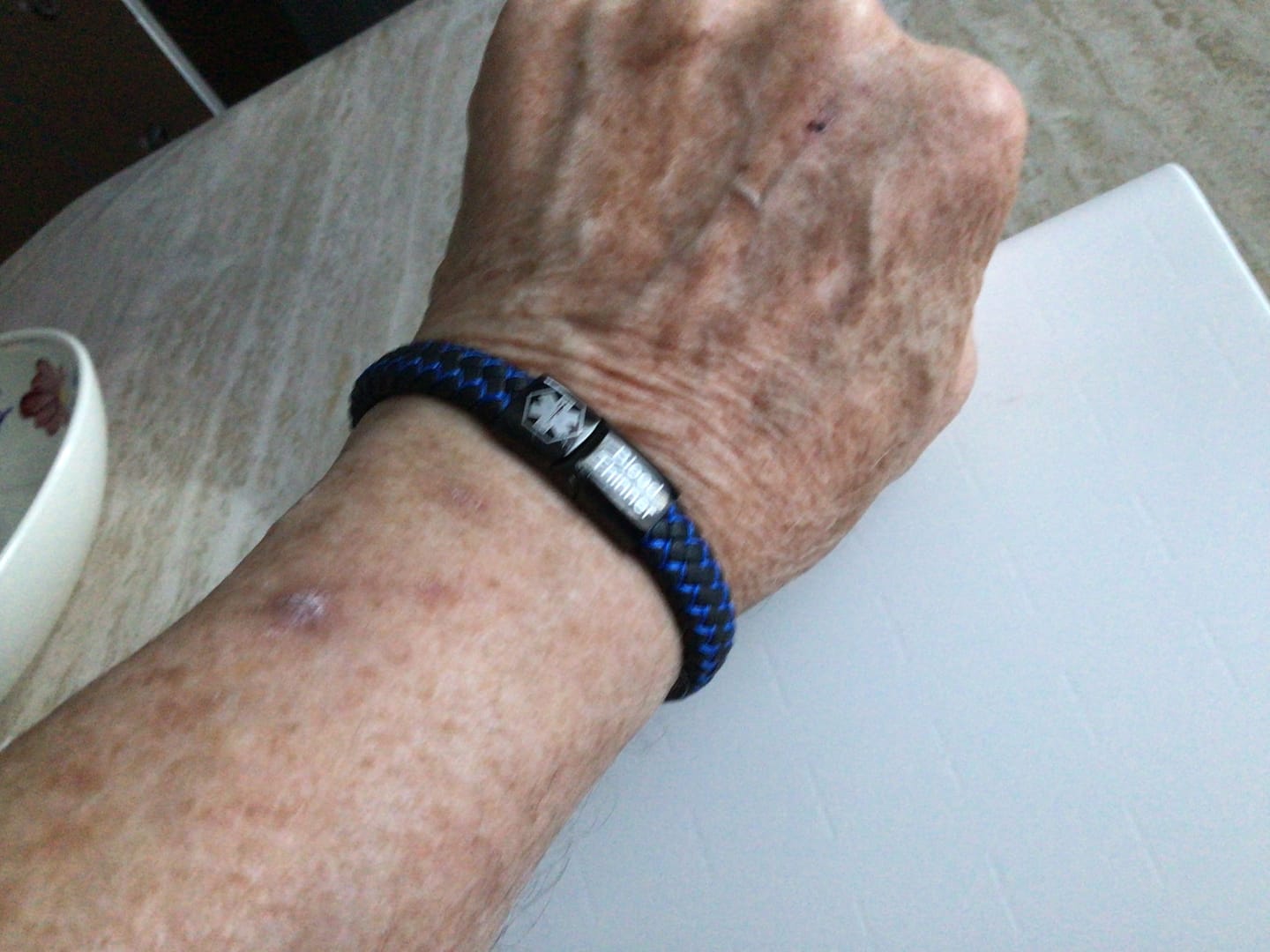 Customer photo review of Medische Waarschuwingsarmband