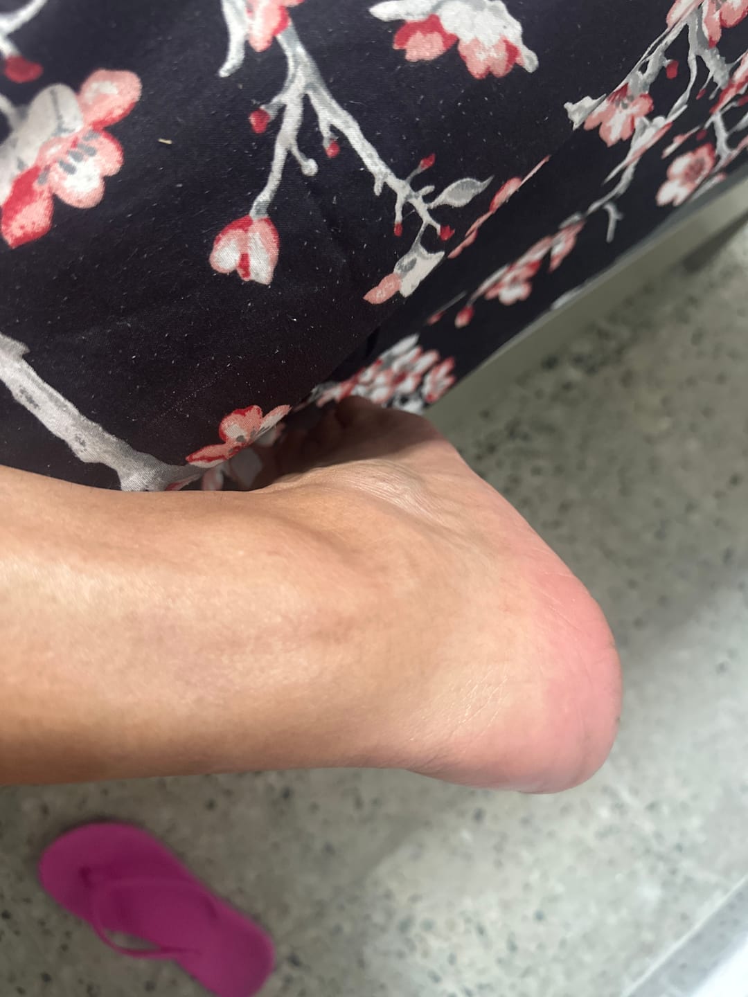 Customer photo review of Foot Balm