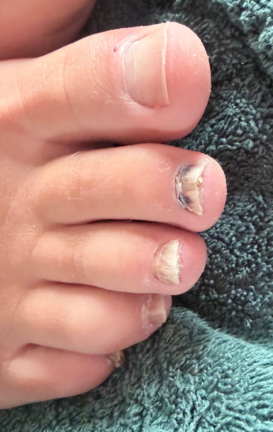 Customer photo review of Fungal Freedom